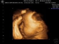 Click image for larger version

Name:	4d-1.jpg
Views:	238
Size:	5.6 KB
ID:	243054