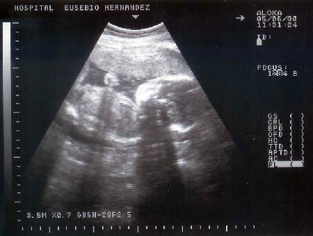 Click image for larger version

Name:	ultrasonido.jpg
Views:	226
Size:	23.1 KB
ID:	243056