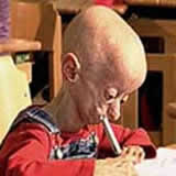 Click image for larger version

Name:	2 progeria.jpg
Views:	1546
Size:	5.0 KB
ID:	244851