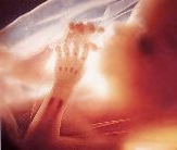 Click image for larger version

Name:	feto_12.jpg
Views:	197
Size:	14.1 KB
ID:	245930