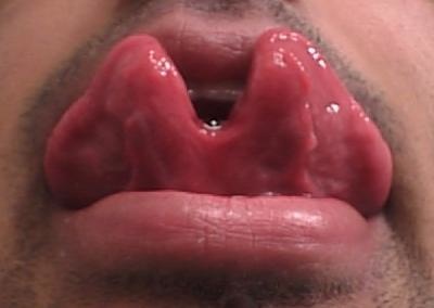 Click image for larger version

Name:	7 tongue splitting.jpg
Views:	825
Size:	24.6 KB
ID:	246129