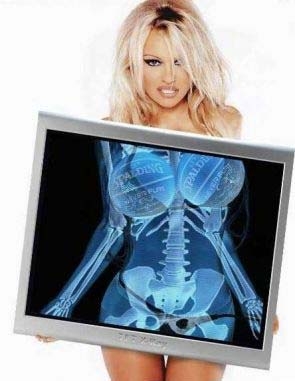 Click image for larger version

Name:	pamela-anderson-xray-boobs.JPG
Views:	204
Size:	53.6 KB
ID:	247051
