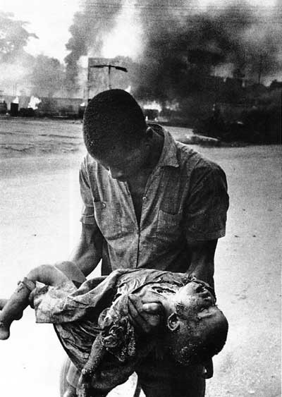 Click image for larger version

Name:	bnw-carlisle-umunna-nigeria-biafra-war-child-casualty-3.jpg
Views:	318
Size:	56.9 KB
ID:	247757
